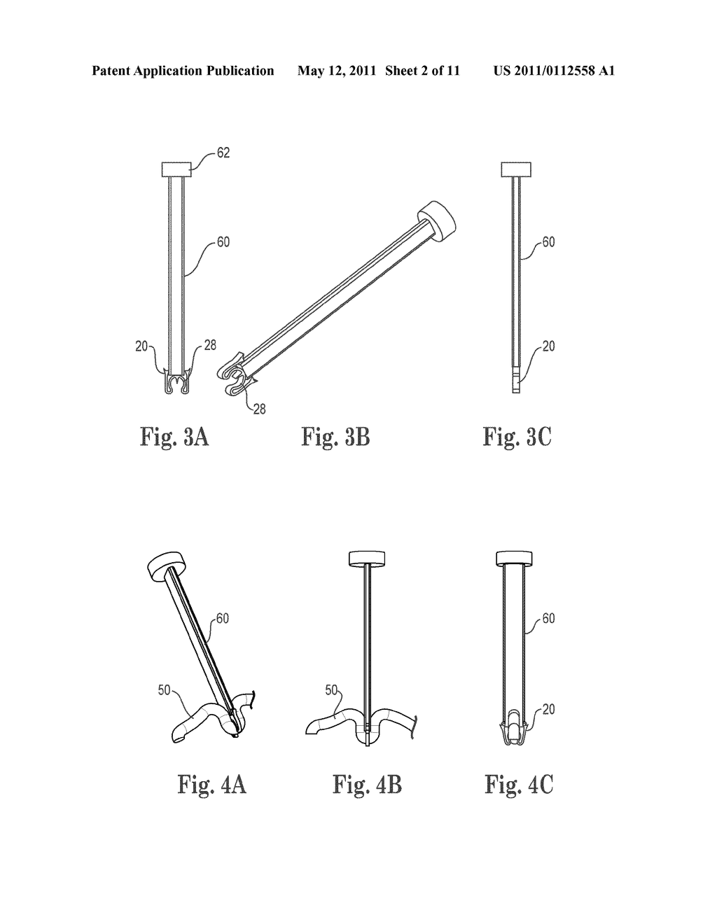 TISSUE FIXATION SYSTEM WITH SINGLE COMPONENT ANCHOR - diagram, schematic, and image 03