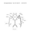 EXPANDABLE CEREBROVASCULAR SHEATH AND METHOD OF USE diagram and image