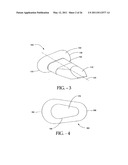 INTERSPINOUS PROCESS IMPLANT HAVING DEPLOYABLE WINGS AND METHOD OF IMPLANTATION diagram and image