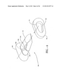 INTERSPINOUS PROCESS IMPLANT HAVING DEPLOYABLE WINGS AND METHOD OF IMPLANTATION diagram and image