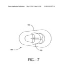 INTERSPINOUS PROCESS IMPLANT HAVING DEPLOYABLE WINGS AND METHOD OF IMPLANTATION diagram and image