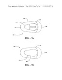 INTERSPINOUS PROCESS IMPLANT HAVING DEPLOYABLE WINGS AND METHOD OF IMPLANTATION diagram and image