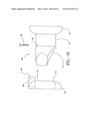 INTERSPINOUS PROCESS IMPLANT HAVING DEPLOYABLE WINGS AND METHOD OF IMPLANTATION diagram and image