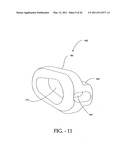 INTERSPINOUS PROCESS IMPLANT HAVING DEPLOYABLE WINGS AND METHOD OF IMPLANTATION diagram and image