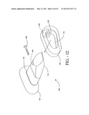 INTERSPINOUS PROCESS IMPLANT HAVING DEPLOYABLE WINGS AND METHOD OF IMPLANTATION diagram and image