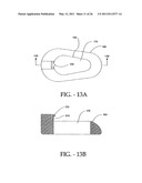 INTERSPINOUS PROCESS IMPLANT HAVING DEPLOYABLE WINGS AND METHOD OF IMPLANTATION diagram and image