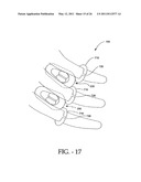 INTERSPINOUS PROCESS IMPLANT HAVING DEPLOYABLE WINGS AND METHOD OF IMPLANTATION diagram and image