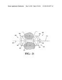 INTERSPINOUS PROCESS IMPLANT HAVING DEPLOYABLE WINGS AND METHOD OF IMPLANTATION diagram and image