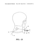 INTERSPINOUS PROCESS IMPLANT HAVING DEPLOYABLE WINGS AND METHOD OF IMPLANTATION diagram and image