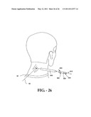 INTERSPINOUS PROCESS IMPLANT HAVING DEPLOYABLE WINGS AND METHOD OF IMPLANTATION diagram and image