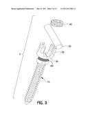 Spring-Loaded, Load Sharing Polyaxial Pedicle Screw Assembly and Method diagram and image