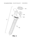 Spring-Loaded, Load Sharing Polyaxial Pedicle Screw Assembly and Method diagram and image