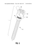 Spring-Loaded, Load Sharing Polyaxial Pedicle Screw Assembly and Method diagram and image