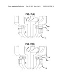 Spring-Loaded, Load Sharing Polyaxial Pedicle Screw Assembly and Method diagram and image