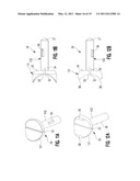 Spring-Loaded, Load Sharing Polyaxial Pedicle Screw Assembly and Method diagram and image