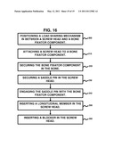 Spring-Loaded, Load Sharing Polyaxial Pedicle Screw Assembly and Method diagram and image