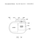 MRI SIGNAL FILTERING FOR IMPLANTABLE MEDICAL DEVICE diagram and image