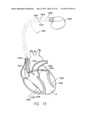 MRI SIGNAL FILTERING FOR IMPLANTABLE MEDICAL DEVICE diagram and image