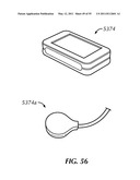 SYSTEM FOR STIMULATING A HYPOGLOSSAL NERVE FOR CONTROLLING THE POSITION OF A PATIENT S TONGUE diagram and image