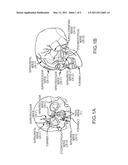 Extracranial implantable devices, systems and methods for the treatment of neuropsychiatric disorders diagram and image