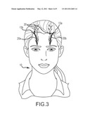 Extracranial implantable devices, systems and methods for the treatment of neuropsychiatric disorders diagram and image