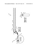 Using the Case of an Implantable Medical Device to Broaden Communication Bandwidth diagram and image