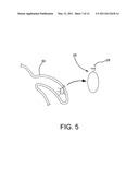 DRUG ELUTING COMPOSITE diagram and image