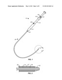 APPARATUS AND METHOD FOR DEPLOYING STENT ACROSS ADJACENT TISSUE LAYERS diagram and image