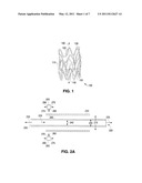 Stents with Enhanced Fracture Toughness diagram and image