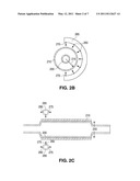 Stents with Enhanced Fracture Toughness diagram and image