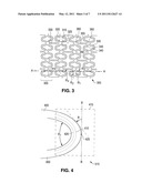 Stents with Enhanced Fracture Toughness diagram and image