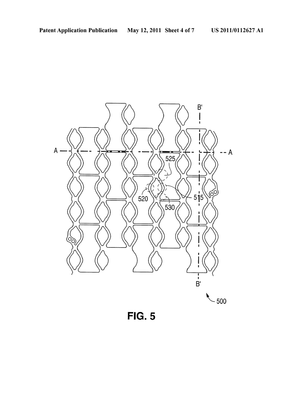 Stents with Enhanced Fracture Toughness - diagram, schematic, and image 05