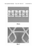 Stents with Enhanced Fracture Toughness diagram and image