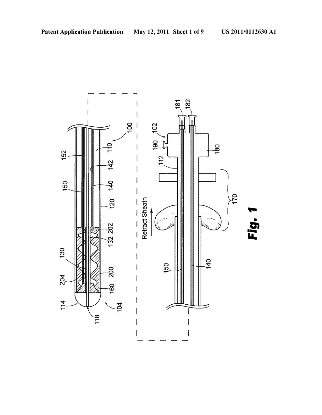 SYSTEMS AND METHODS FOR TREATING LUMENAL VALVES - diagram, schematic, and image 02