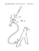 TRANSAPICAL DELIVERY SYSTEM WITH VENTRUCULO-ARTERIAL OVERLFOW BYPASS diagram and image