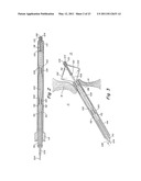 DELIVERY/RECOVERY SYSTEM FOR SEPTAL OCCLUDER diagram and image