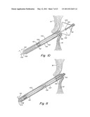 DELIVERY/RECOVERY SYSTEM FOR SEPTAL OCCLUDER diagram and image