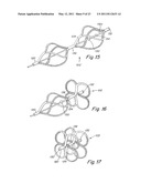 DELIVERY/RECOVERY SYSTEM FOR SEPTAL OCCLUDER diagram and image