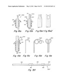 DELIVERY/RECOVERY SYSTEM FOR SEPTAL OCCLUDER diagram and image