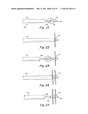 DELIVERY/RECOVERY SYSTEM FOR SEPTAL OCCLUDER diagram and image