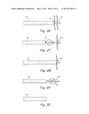 DELIVERY/RECOVERY SYSTEM FOR SEPTAL OCCLUDER diagram and image