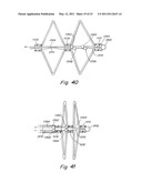 DELIVERY/RECOVERY SYSTEM FOR SEPTAL OCCLUDER diagram and image