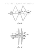 DELIVERY/RECOVERY SYSTEM FOR SEPTAL OCCLUDER diagram and image