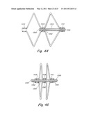 DELIVERY/RECOVERY SYSTEM FOR SEPTAL OCCLUDER diagram and image