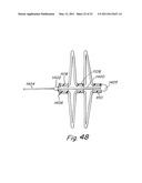 DELIVERY/RECOVERY SYSTEM FOR SEPTAL OCCLUDER diagram and image