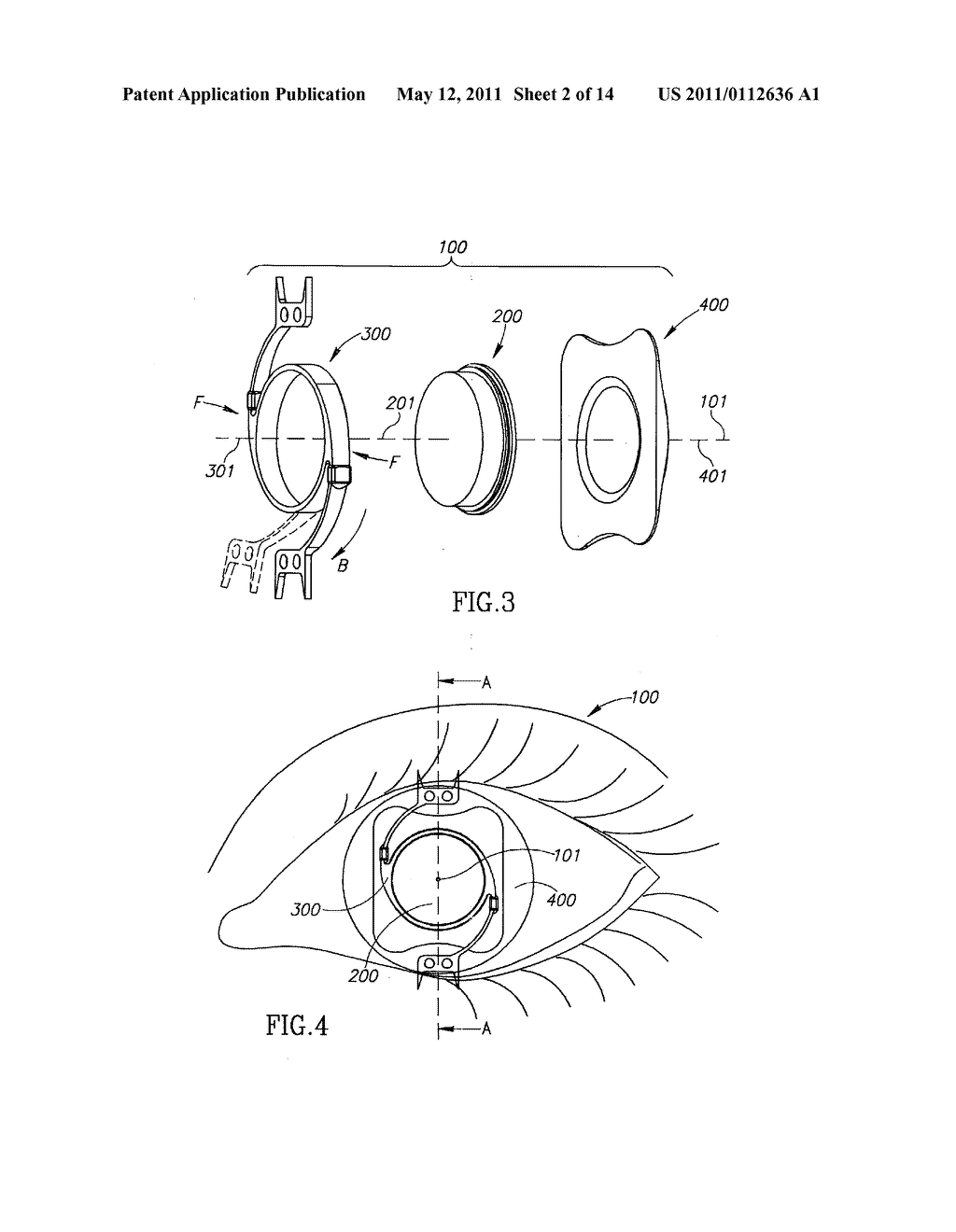 Accommodating Intraocular Lens (AIOL) Capsules - diagram, schematic, and image 03