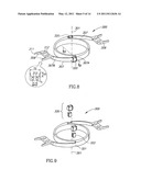 Accommodating Intraocular Lens (AIOL) Capsules diagram and image