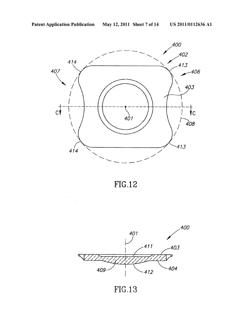 Accommodating Intraocular Lens (AIOL) Capsules - diagram, schematic, and image 08