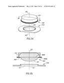 Accommodating Intraocular Lens (AIOL) Capsules diagram and image