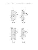 Accommodating Intraocular Lens (AIOL) Capsules diagram and image